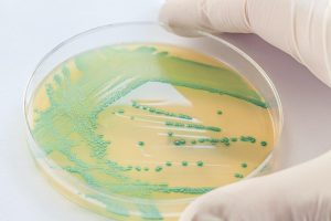 Listeria Monocytogenes