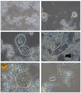 Analisi Microbiologica Fanghi Attivi SSICA Articoli Scientifici Analisi Microbiologica Fanghi Attivi SSICA Articoli Scientifici