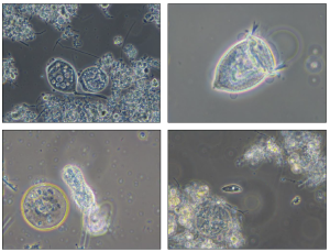 analisi microbiologica fanghi attivi